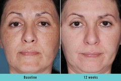 DARK SKIN WHITENING LIGHTENING ULTRA BRIGHTENING SERUM Dark Spot Bleaching Cream