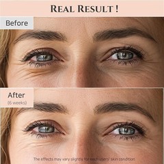 BEAUTY OF JOSEON Retinal Eye Serum | Puffiness, Wrinkles, Brightening