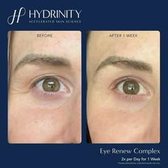 Eye Renew Complex-delivers powerful hydration to the delicate skin around your.