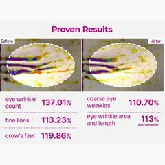 Dr.Melaxin – Cemenrete Calcium Volume Eye Patch
