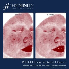 PRELUDE Facial Treatment Cleanser-cleanse away makeup, excess oils,impurities.