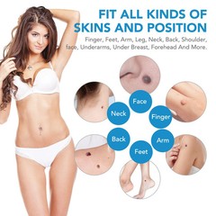 2in1 Skin Tag Remover Kit Micro Device Safe Removal 2-8 mm Painless Tool