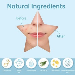 REDANHA 200 Count Star Pimple Patches for 1 (Pack of 200), The Stars