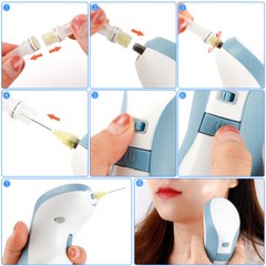 Professional Fibroblast Eyelid Lifting Wrinkle/Spot Removal Laser Plasma Pen