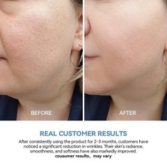 60PCS 3% Hyaluronic Acid Serum – Anti-Aging & Hydrating for Dry & Sensitive Skin