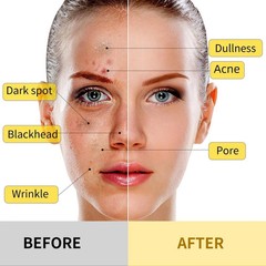 Turmeric Vitamin C Facial Mask Exfoliating Deep Clean Pores Skin Brightening