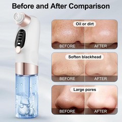 Ultra Pro Blackhead Remover Vacuum Electric Pore Cleaner Acne Black Dot Tool USB