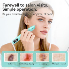 Skintag Remover for At-Home Use, Designed for Gentle Removal and Everyday Person