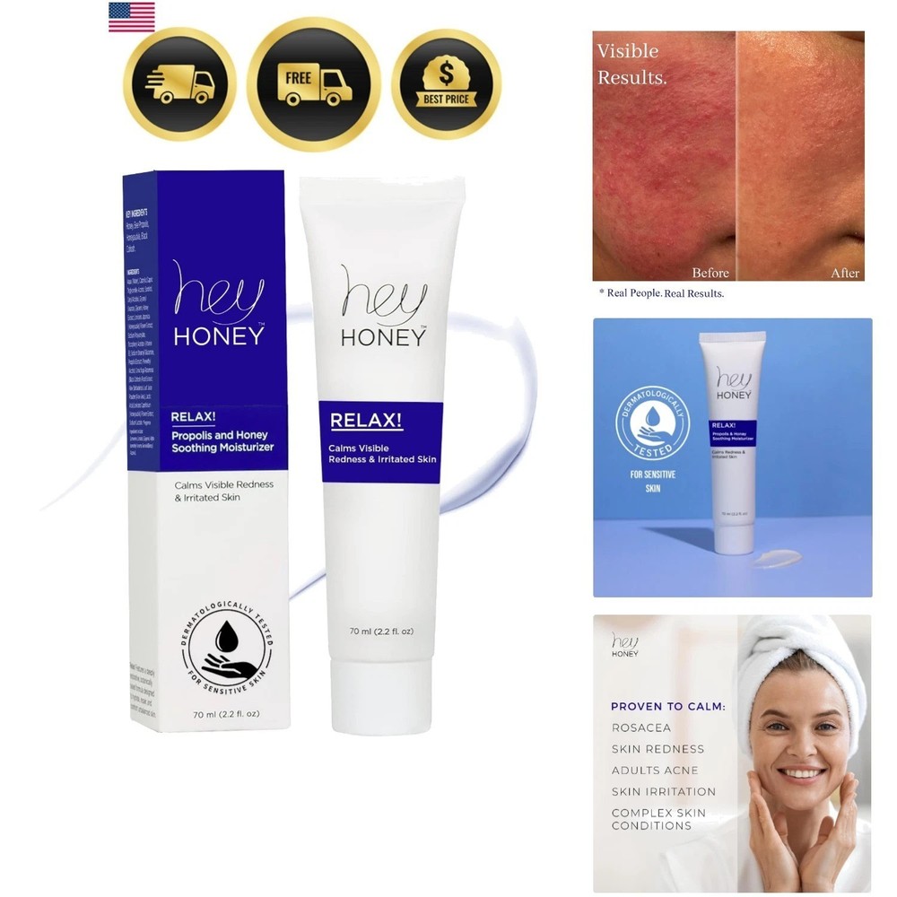 Skincare Relax – Instant Rosacea Relief Cream for Sensitive Skin | Calming Fa…
