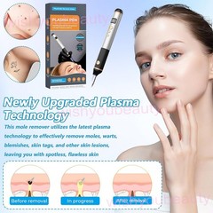 Plasma Pen 15 Levels Electric Fibroblast Skin Tag Mole Wart Freckle Remover