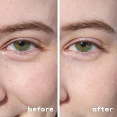 MARIO BADESCU Hydrogel Under Eye Patches For Puffy Eyes, Dark Circles (30 Pairs)