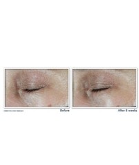 RoC MULTI CORREXION Hydrate + Plump Eye Cream Peptides Hyaluronic Acid 0.5 oz