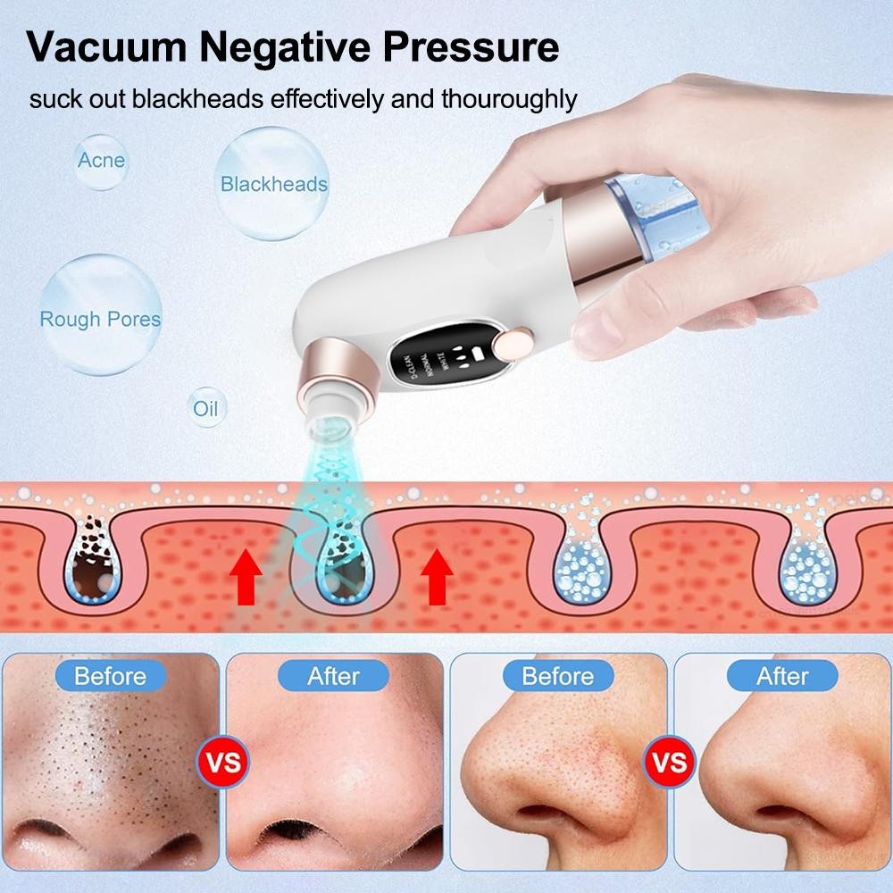 Ultra Pro Blackhead Remover Vacuum Electric Pore Cleaner Acne Black Dot Tool USB