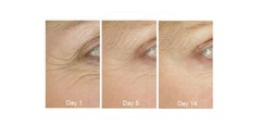 DEEP WRINKLE DEFENSE PEPTIDE COMPLEX
