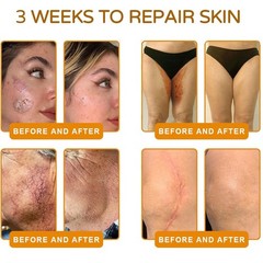 VLSVLS Bee Venom skin Treatment Cream, Improved Firming & Wrinkle-Reducing cream