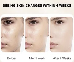 Anti-Aging Vitamin C Facial Serum Moisturizing, Brightening Day/Night Lot Of 2