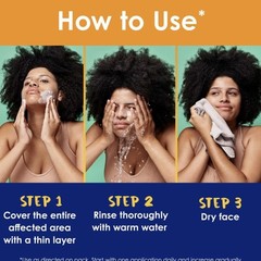 Clearasil Stubborn Acne Control 5in1 6.76 Fl Oz (Pack of 1), White