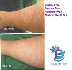Extreme Crepey Skin Body & Face Cream W/ Hyaluronic Acid,Alpha Hydroxy,Unscented