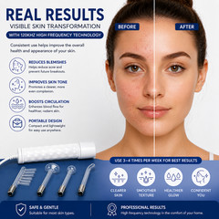 High Frequency Facial Wand Machine Acne Anti Aging Hair Scalp Care Set