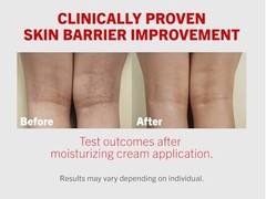 ATOPALM Intensive Moisturizing Cream for Dry & Sensitive Skin, Face Moisturizer,