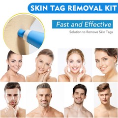 2-8 mm Micro Auto TagBand Skin Tag Remover Device for Small to Medium Skin Tags