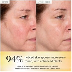 Fast-Absorbing Face Oil with Jojoba & Sea Buckthorn – 1.69oz