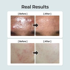 numbuzin No.1 Toner | Pure-Full Calming Herb Toner. Breakouts, Redness 10.14 fl.