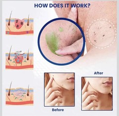 NatureErase Cream, Skin Repair, Natural Ingredients Suitable for All Skin Types
