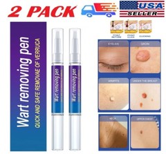 2× Wart Remover Pen Eliminate Skin Tag Foot Corn Mole Warts Restoration Painless