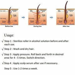 Derma Roller for Hair Loss Beard Growth 0.5-2.0mm Microneedle Dermaroller US