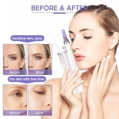 Mini Electric Nano Water Gun And Replacement Pins/Tube Anti-aging Facial Machine