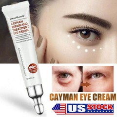 Magic Eye Cream 28 seconds remove eye bags dark circles eye wrinkles Anti Aging