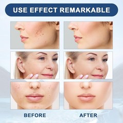 3 Pcs Liquid Facial Serum – Anti-Aging, Boost Collagen, Smooth Lines & Wrinkles.