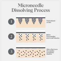 Wrinkles Schminkles Self Dissolving Microneedle Patches 8 Facial Patches Pk