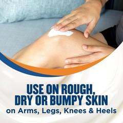 Gold Bond Rough & Bumpy Daily Skin Therapy Cream, 8 oz 8 Ounce (Pack of 1)