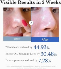 MediCube Zero Pore Pad 2.0 | Dual-Textured Exfoliating Toner Pads,Pore Refining
