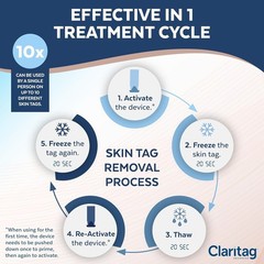 Advanced Cryogenic Skin Tag Removal Kit – 10 Treatments, Results in 7-14 Days