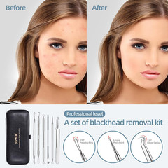 Professional Blackhead Remover and Comedone Extractor Tool Kit