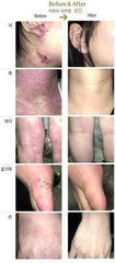 3 Lot of ISAL Atopy Eczema Cream Lotion./Made in USA
