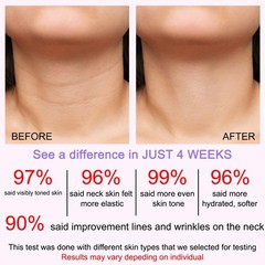 TYTCA Newly Upgraded AH-8 Firming Neck Cream With 4.23 Ounce (Pack of 1)