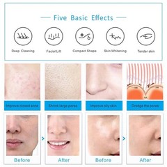 7 Colors PDT LED Light Photon Therapy Face Neck Mask Skin Rejuvenation Machine