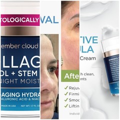 Hydrating Anti-Aging Face Cream with Stem Cells & Retinol – Day
