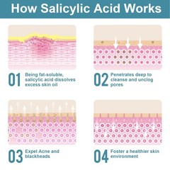 Salicylic Acid Powder (4.58 oz/130 g), Ultra Pure 4.58 Ounce (Pack of 1)