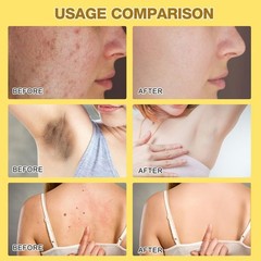 Bee Venom Treatment Cream, 2026 New Professional Bee Venom Repair Cream, For …