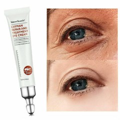 Under Eye Cream Gel Remove Dark Circles Crows Feet Bags Lift Firm Anti Aging US