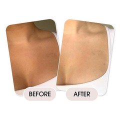Niconi Women Enzyme De-Tan Pack For Face & Body (300g) Pack of 1