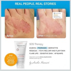 Clinically Tested DermaCalm SOS Therapy by Amelie Monnier