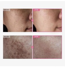 2 PCK-Arbutin7% Tranexamic Acid 4% Cream 50ml Brightening K Beauty FREE SHIP