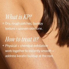 KP Bump Eraser Body Scrub, 10% AHA, 2 oz