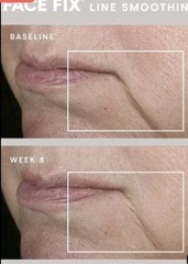 NUFACE ~ LINE SMOOTHING FIX SERUM ~ 0.5oz*FREE SHIP/FREE BRUSH!
